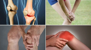 the symptoms of osteoarthritis