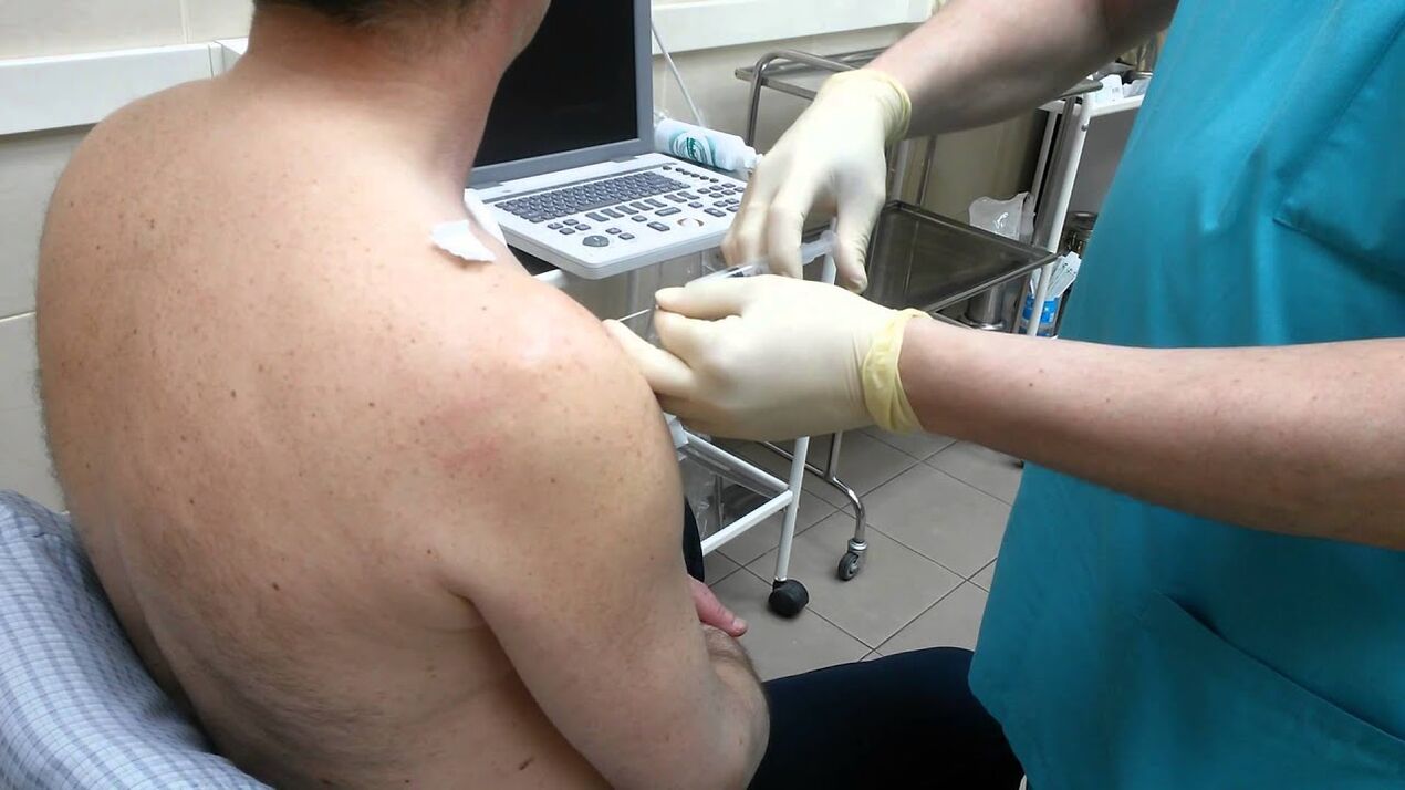 injection into the shoulder in osteoarthritis