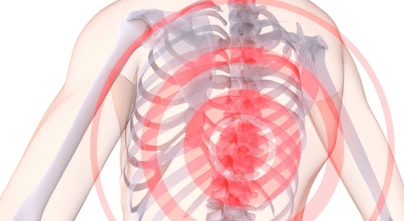 back pain with thoracic osteochondrosis